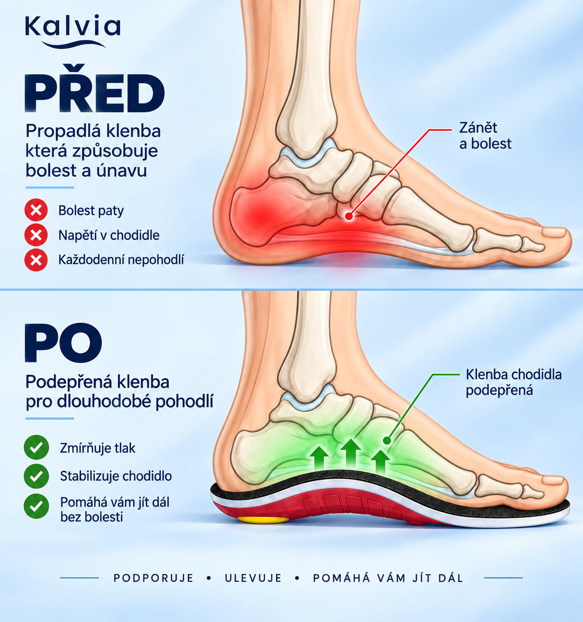 Kalvia™ – Choďte bez bolesti od rána až do večera